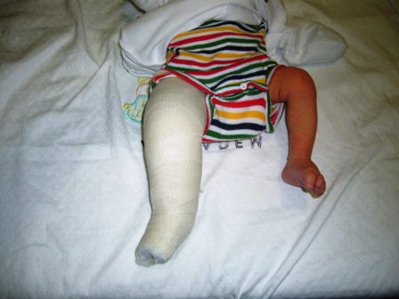 Modern approach to orthopaedic problems in children